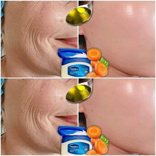 441903644 122149194446101589 5186142649416339052 N