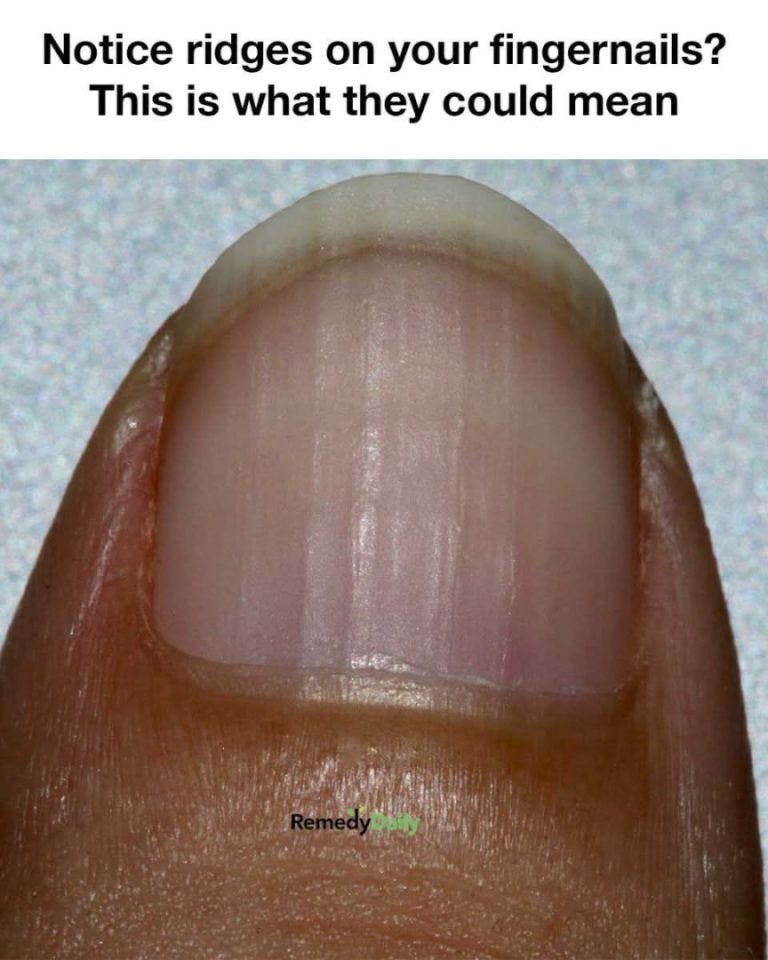 547172759 680005585126990 7029544309373549206 N